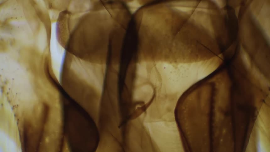 A scientist looks at a bee under a microscope