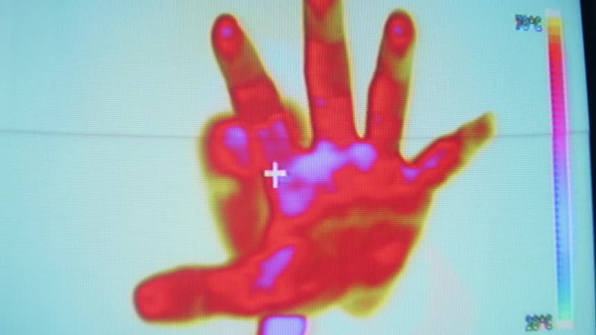 Person holding hand up to thermal camera
