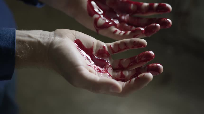 Hands with palms turned up wet with birght red fresh blood dripping from fingers