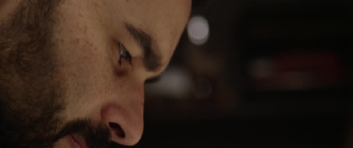 A man with a beard and freckles
