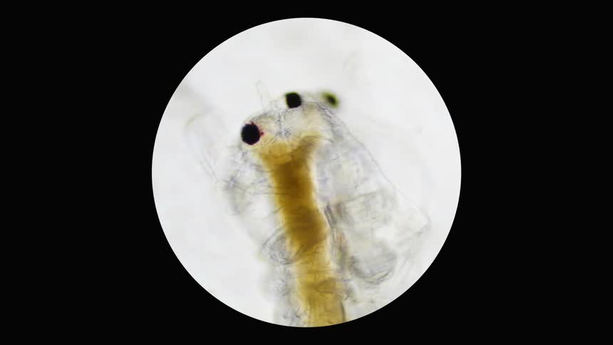 An insect moving on a slide which then zooms in for a closer view