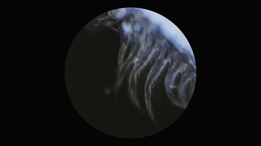 A microscope zooms in on an insect moves it legs back and forth