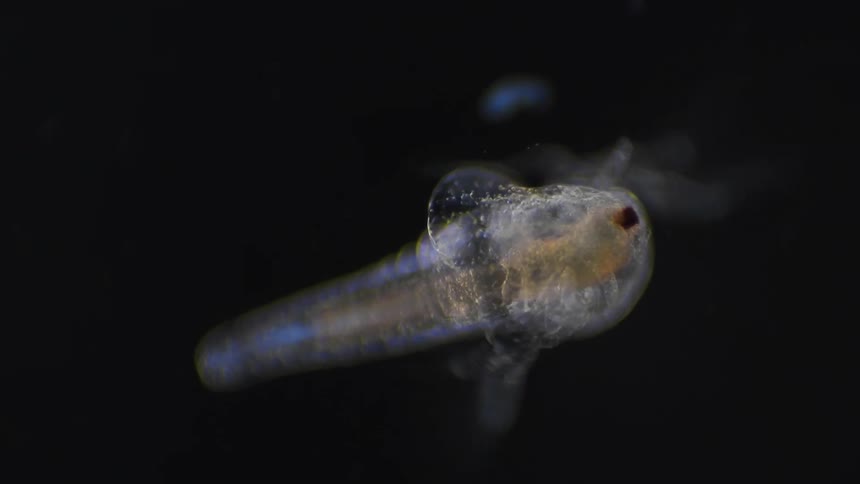 The organism is moving under the microscopic view