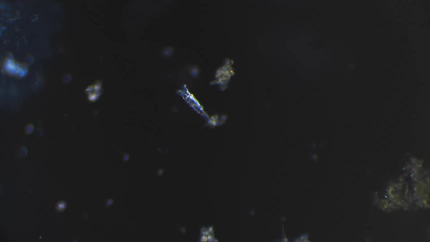 A micro-organism moves gently under a microscope