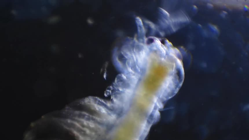 An organism is moving in the dark liquid under a microscope