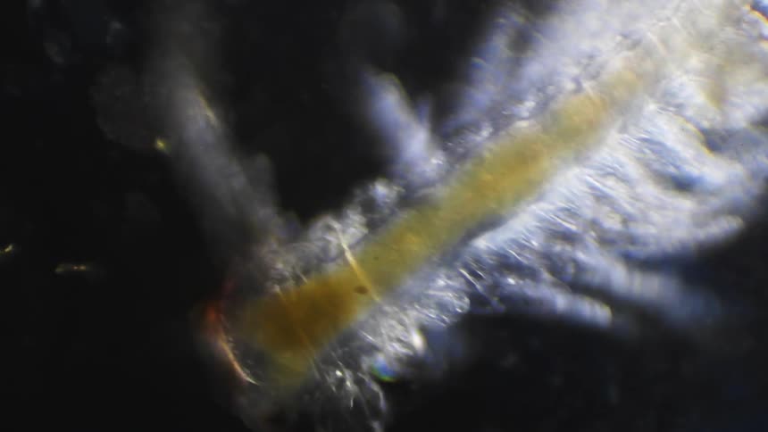 An organism is examined under a microscope against a black background