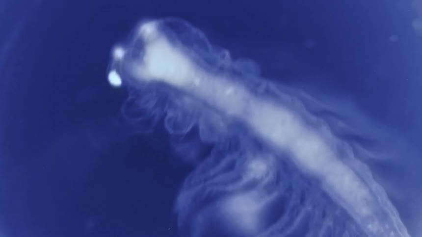 A long insect moves it legs around as it's examined under a microscope