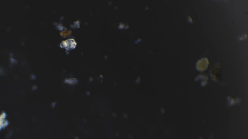 Two organisms moves in the dark under a microscope
