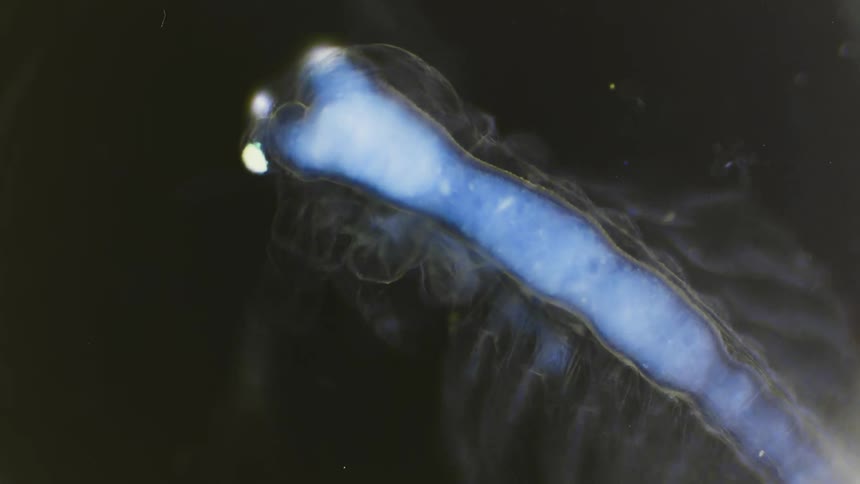 Fluorescent multi limbed aquatic invertebrate swims through the dark under a microscope