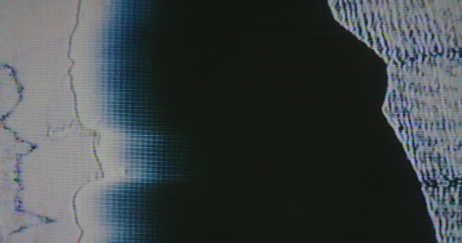 Black and white static displayed on a screen