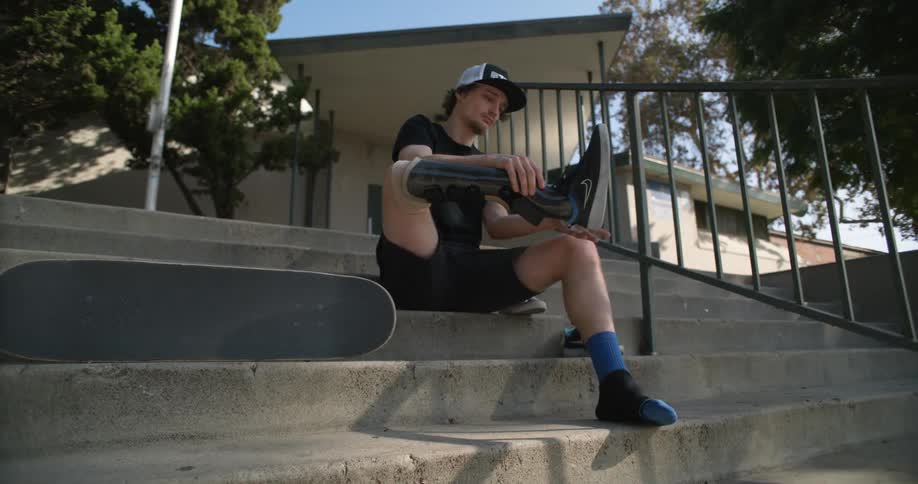 A man with a prosthetic leg sits on some stairs outside next to a skateboard and takes his shoes off