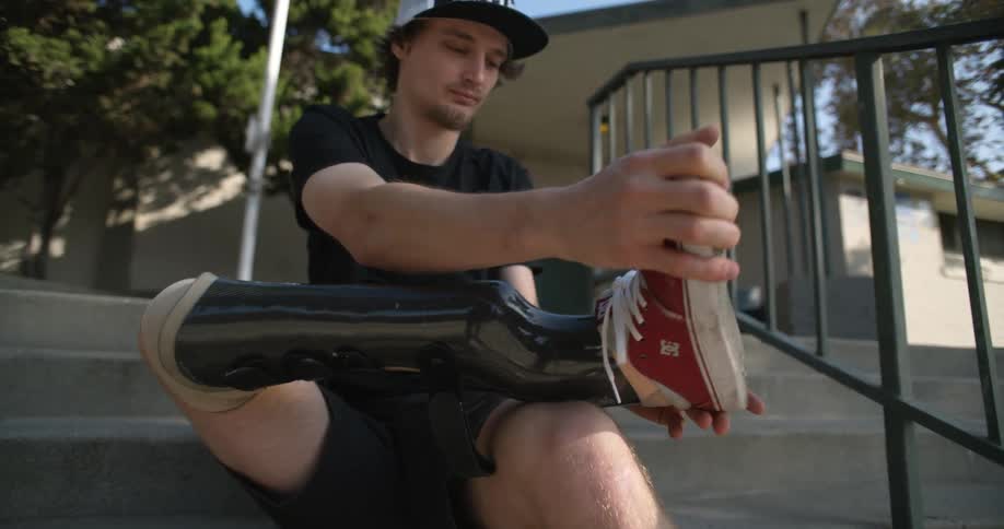 Young man wearing a prosthetic leg puts on shoes while sitting on the stairs near a building