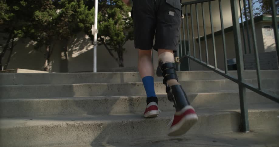 A teenager with a prosthetic leg carries a skateboard as he climbs stairs