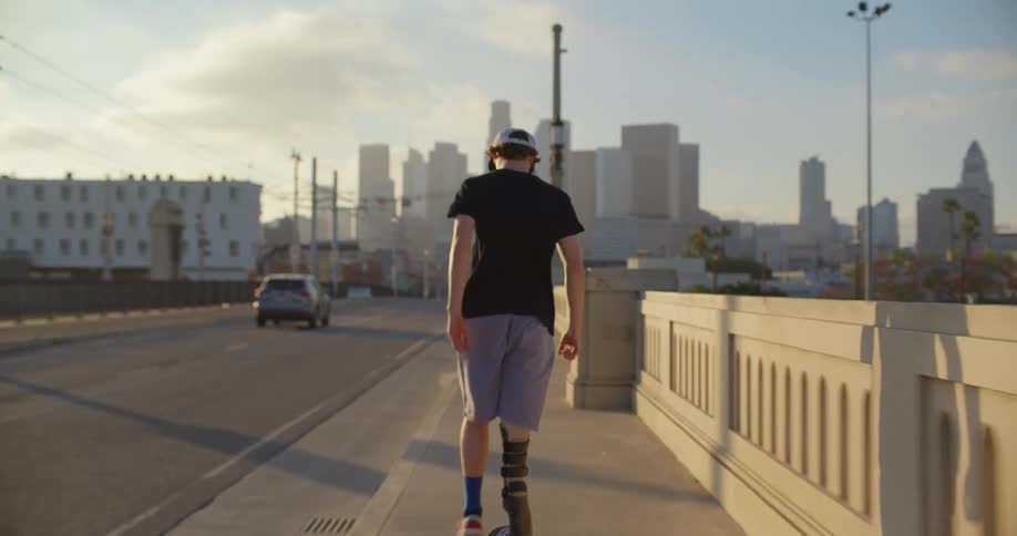 Man with prosthetic leg skateboards along sidewalk past pedestrians standing on bridge with city skyline in distance