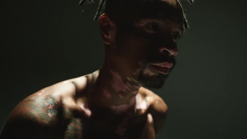 Close up of a man without a shirt on whose vitiligo skin is revealed by flashing lights