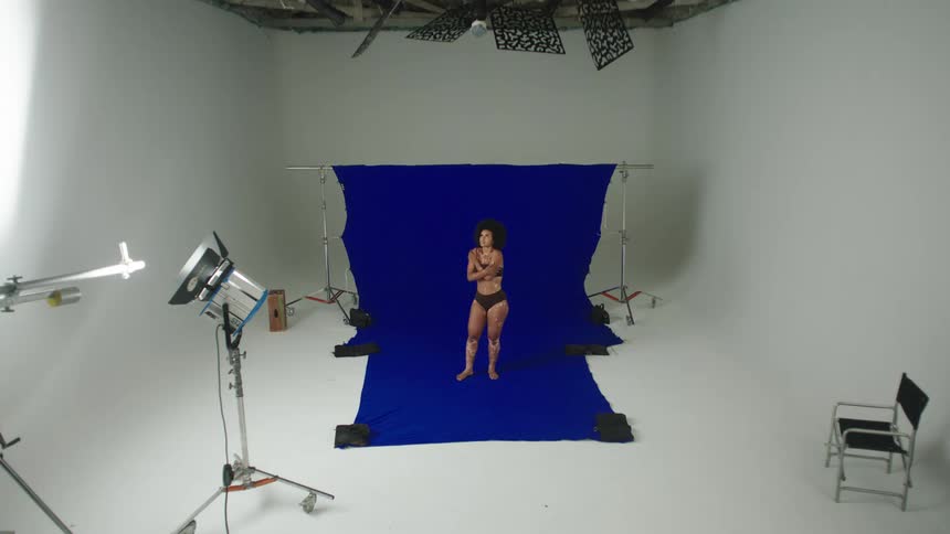 Woman with splotchy skin wearing underwear stands on blue backdrop in a photography set