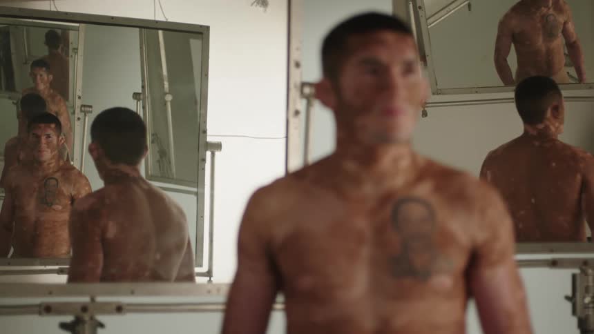 A man with a skin condition poses in front of a mirror