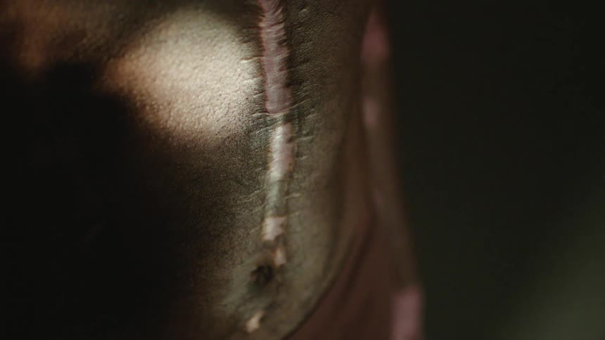 A light shines on the torso and abdomen of a black man showing a scar