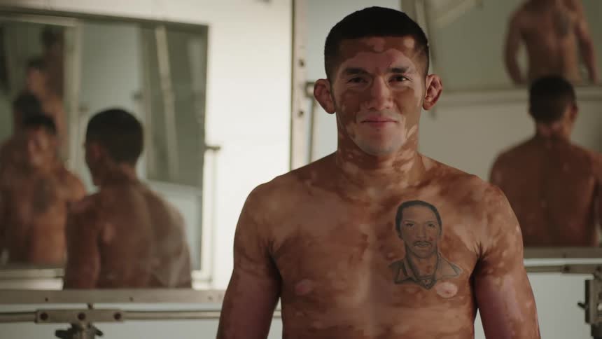 Man with splotchy skin and a tattoo stands smiling in front of a series of mirrors reflecting him and each other