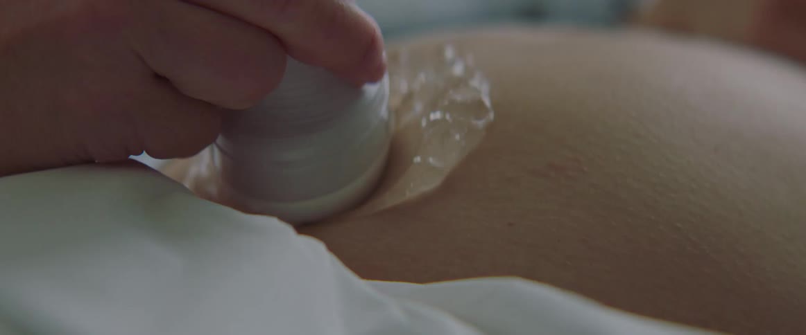 Close up of a pregnant womans stomach with ultrasound jelly on it as another woman moves an ultrasound probe over it