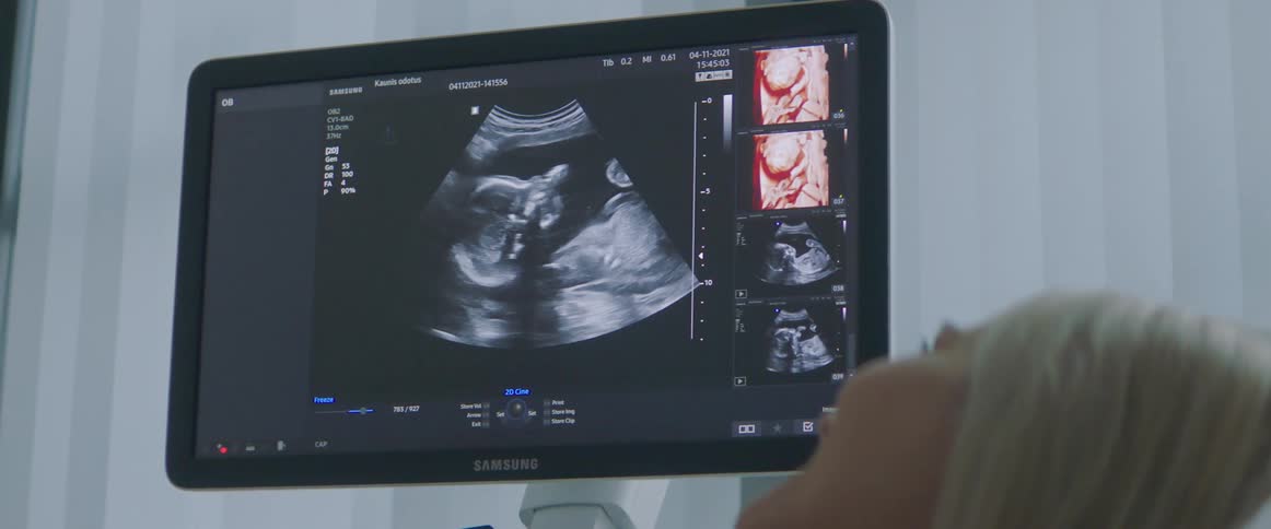 A pregnant woman lying on a hospital bed looks at a sonogram of her belly being displayed on a monitor