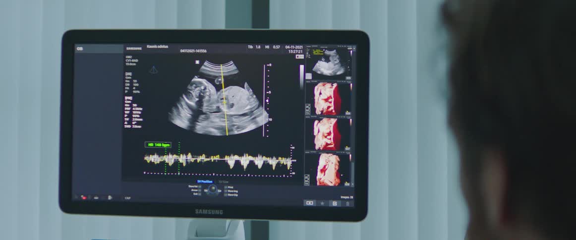 A man looks at an ultrasound on a screen