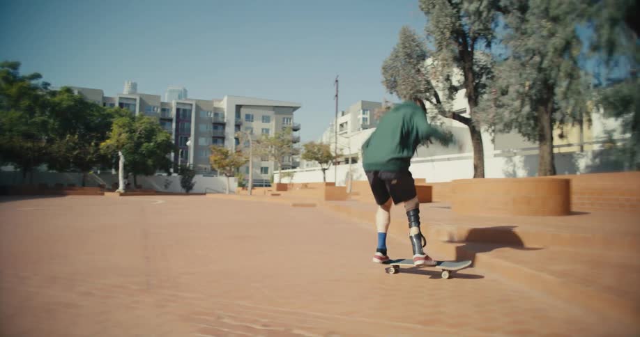 A teenage boy with an artificial leg skateboards up and off curbs in a neighborhood