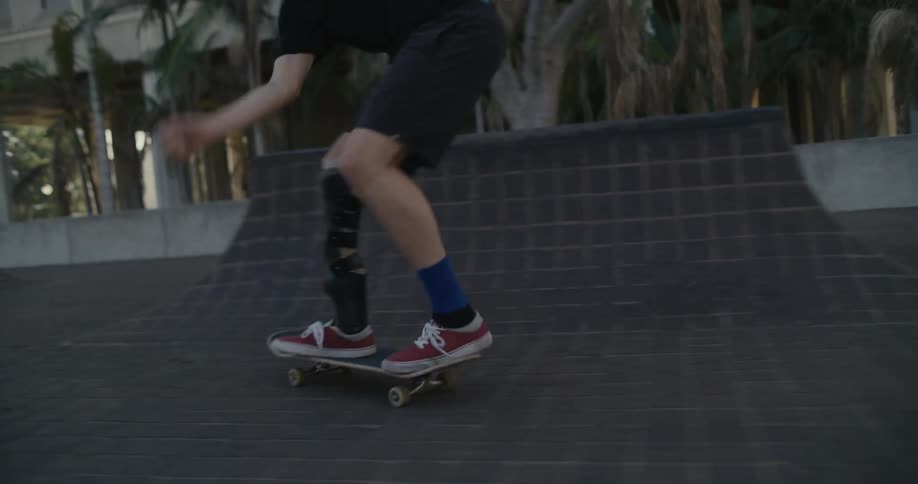 A teenager with a leg cast rides a skateboard in a skate park