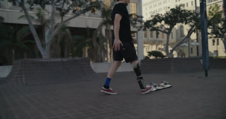 Male skateboarder with prosthetic leg brace jump stairs but falls off board