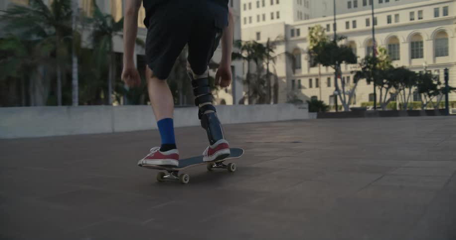 A man with a prosthetic leg skateboards and fails to land a trick on the city walkway