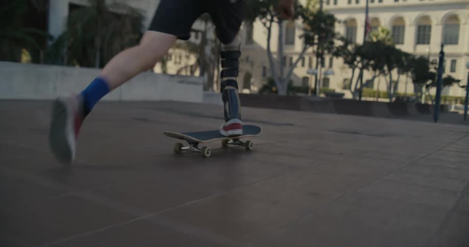 A man with a prosthetic leg jumps over stairs on his skateboard