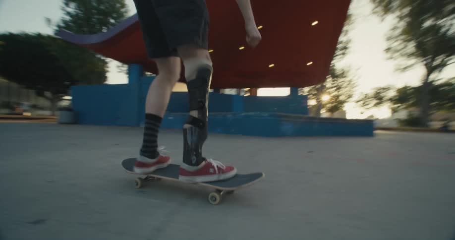 Man with prothetic leg brace performs skateboard trick near park pavilion as another person watches