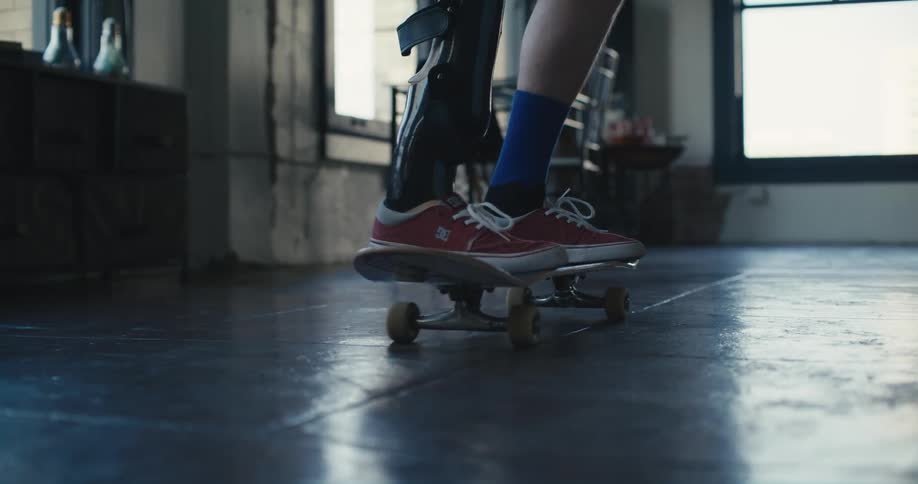 A man with a prosthetic leg tries to balance on a skateboard in a bedroom