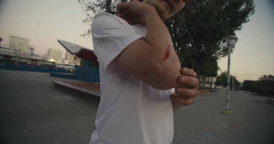 A teenager examines a bleeding cut on his arm while standing in a park