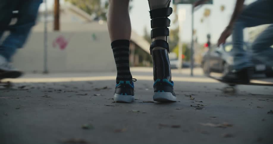 Pedestrian wearing a prosthetic leg stop as skateboarder cross in front of them on sidewalk