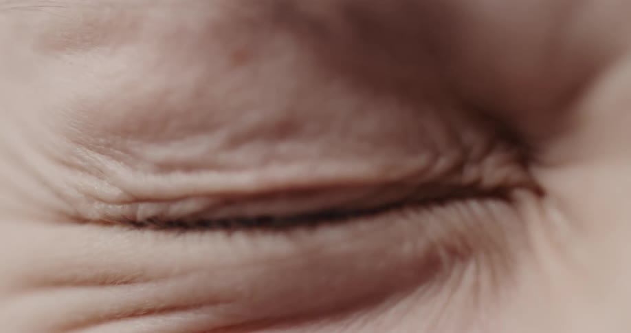 A person squinting the eye