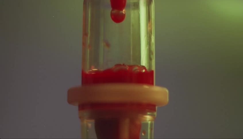 A view of blood dripping in an iv
