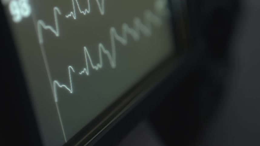 The monitor has a flashing line