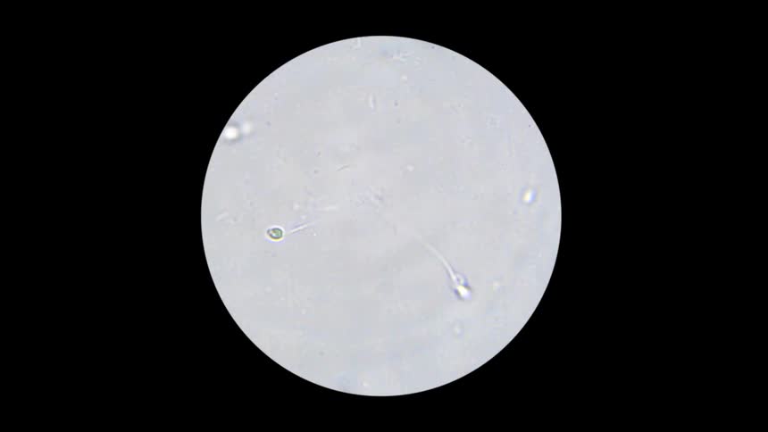 Sperm cells swim under microscope lens