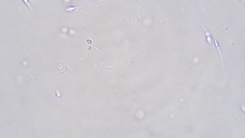Microscopic view of human sperm cells swimming