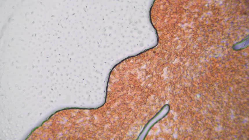 Human blood cells slowly move under a microscope