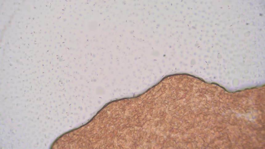 Red blood cells move across a microscope slide