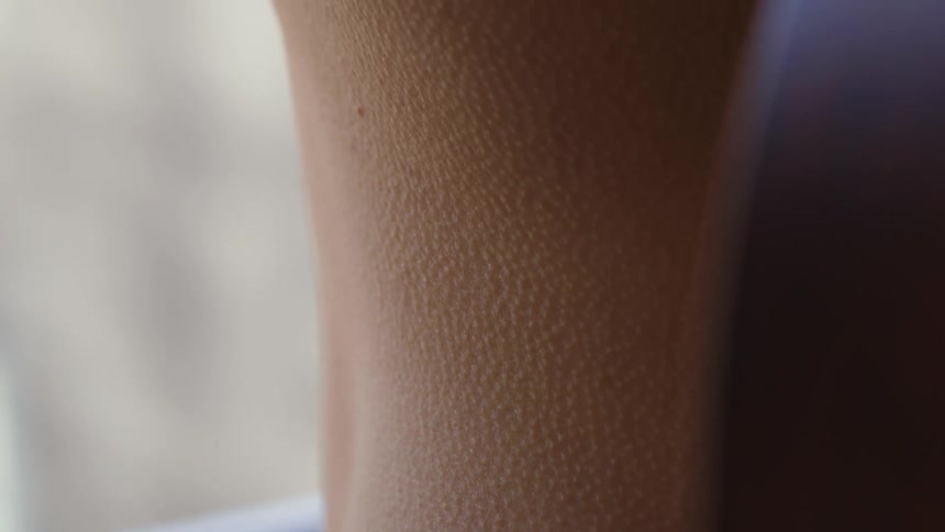 Goosebumps on a persons skin