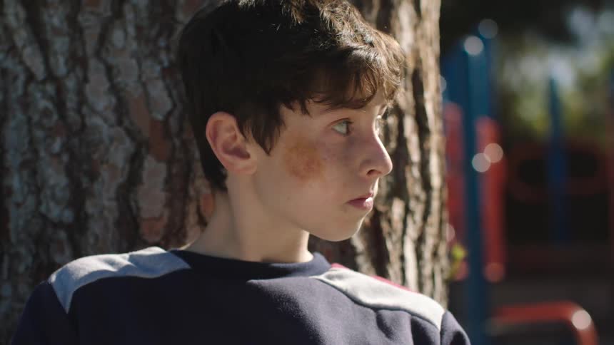 A boy with a bruise on his face is leaning against a tree looking down and then looking around