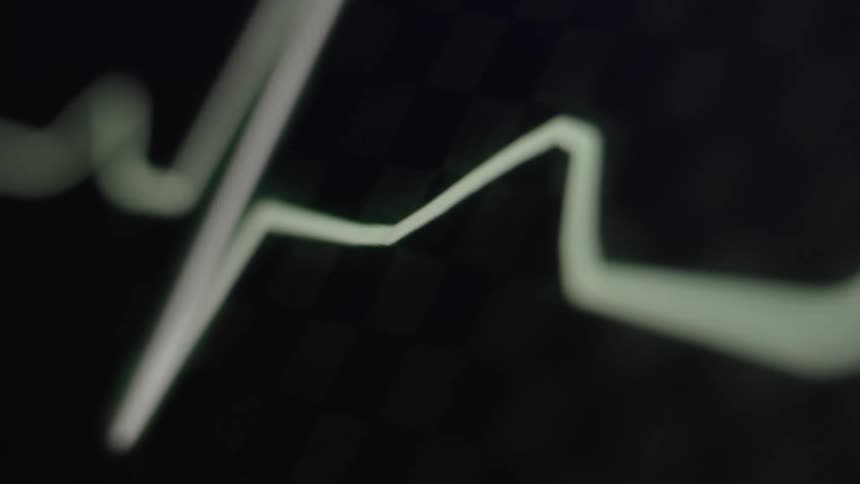 Close up of an electrocardiogram graph pulsing on a screen