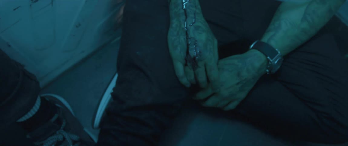 Bloodied arms of a man sitting on the floor of a van under strobing lights