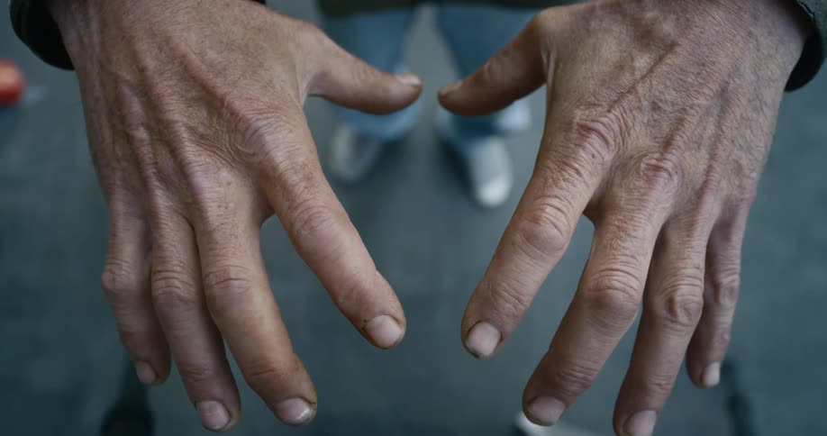A person hangs their hands forward