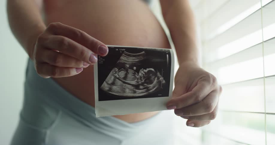 Pregnant woman shows a picture of an ultrasound in front of her belly