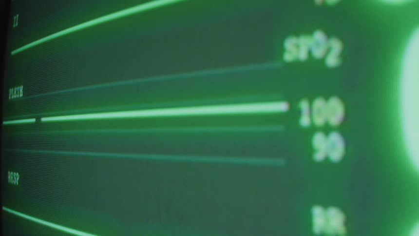The monitor has moving lines