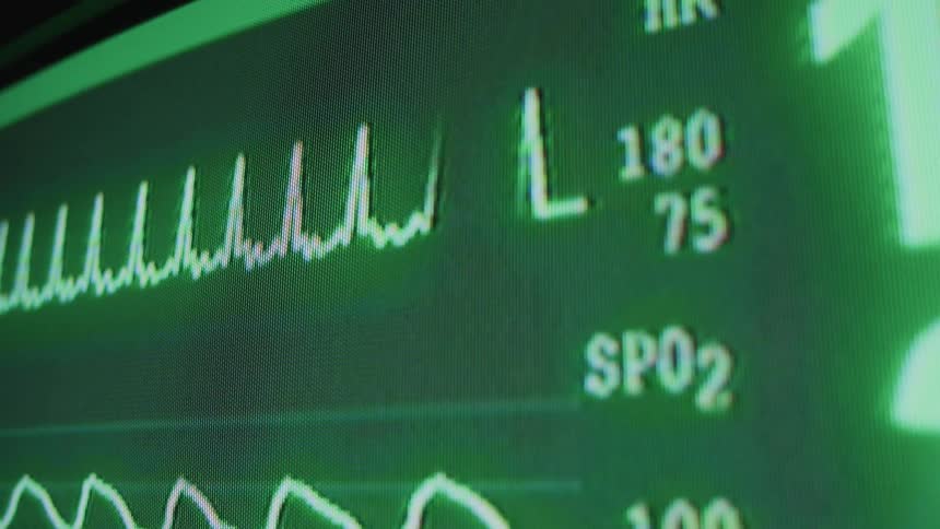 The medical monitor is moving